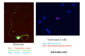 末梢神経に関する基礎研究