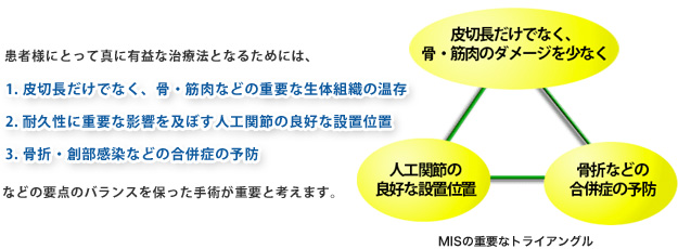 MISの重要なトライアングル