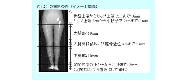 1.人工股関節全置換術後患者の三次元骨格モデルの作成