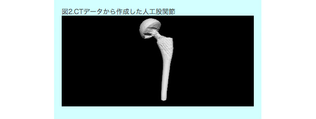 2.CADデータによる人工股関節部分のモデルの精度向上